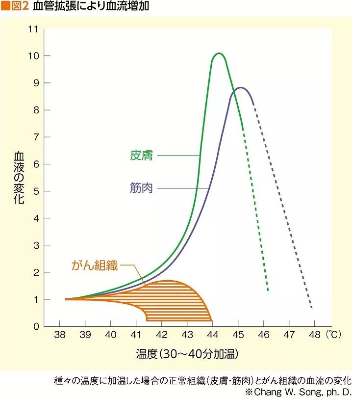 热疗 与抗癌药和放射线疗法的标准治疗并用有惊人效果 维科号